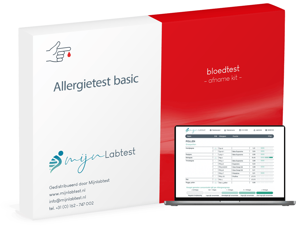 Basis allergietest Basis allergietest
