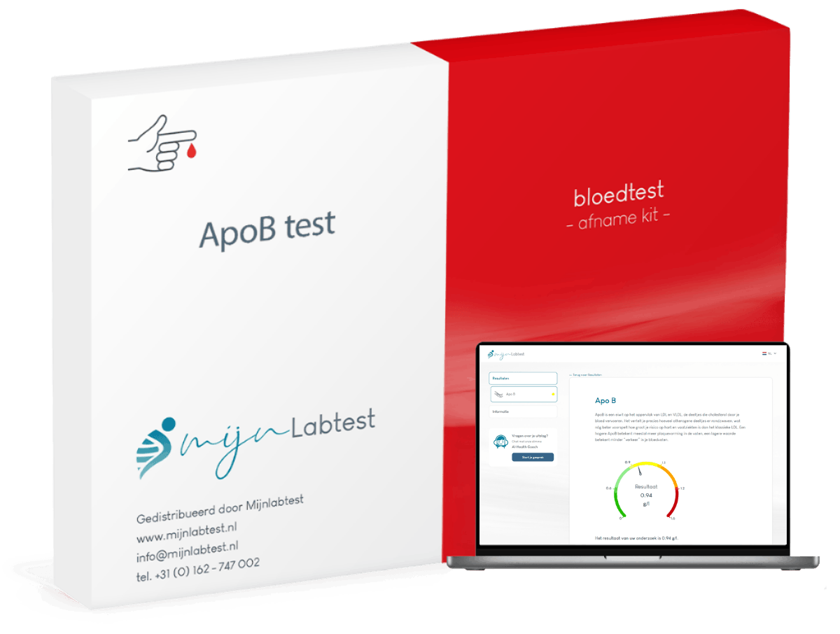 Dit is de ApoB test en een voorbeeld van hoe je uitslag er uit ziet Dit is de ApoB test en een voorbeeld van hoe je uitslag er uit ziet