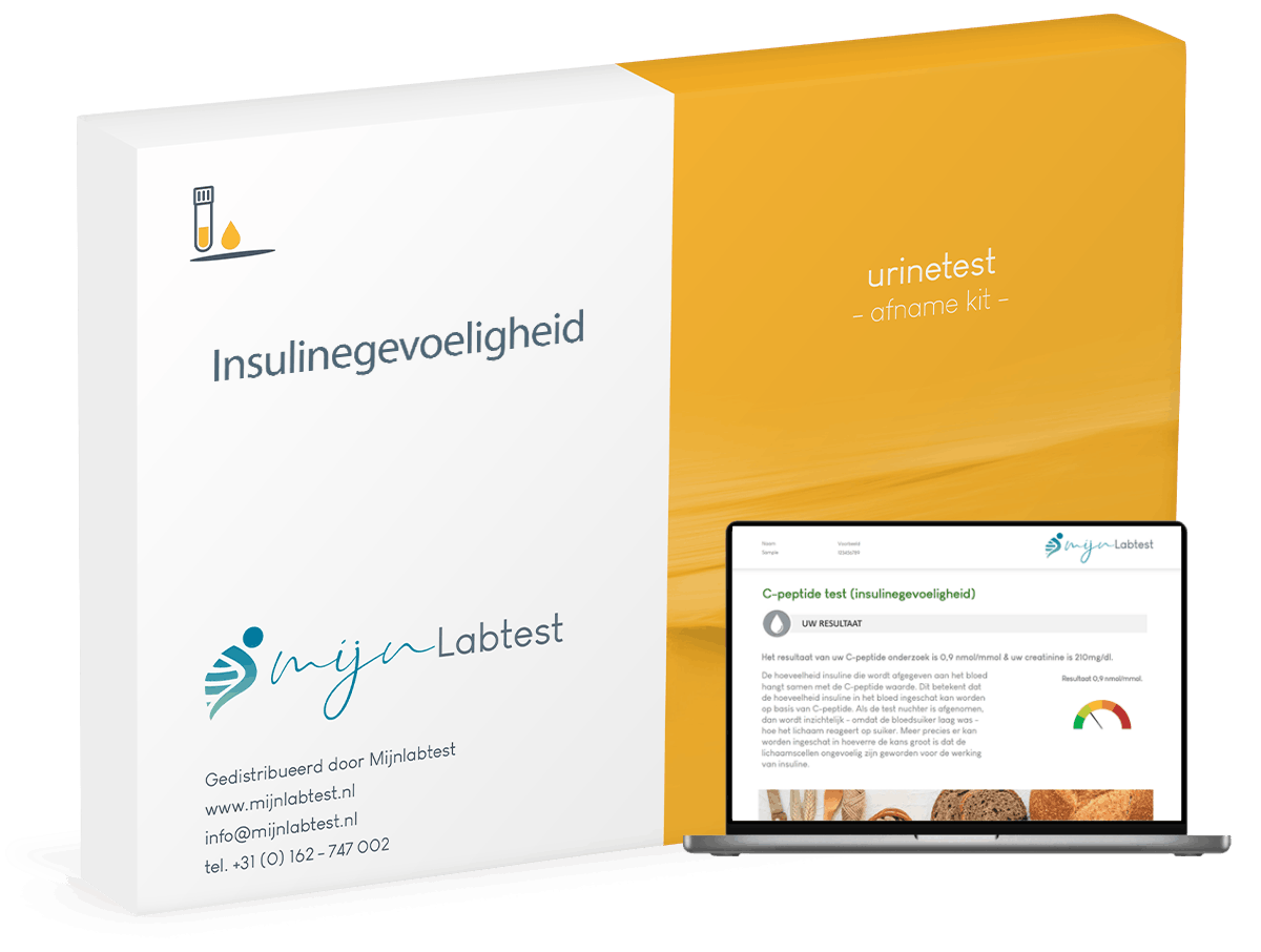 C-peptide test (insulinegevoeligheid)