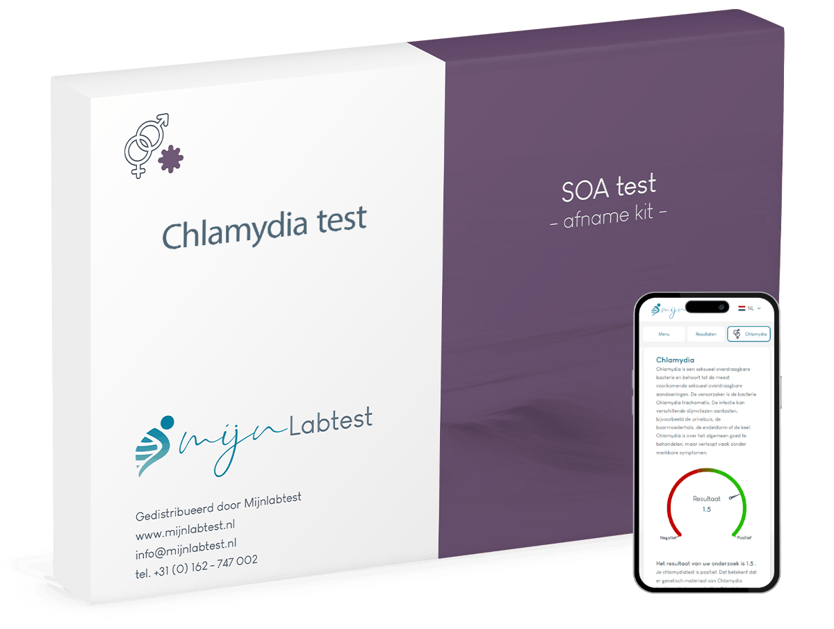Chlamydia test Chlamydia test