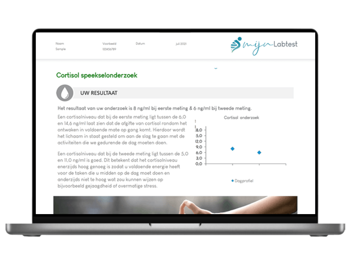 Het resultaat van je cortisol DHEA test wordt beveiligd naar je verstuurd. 