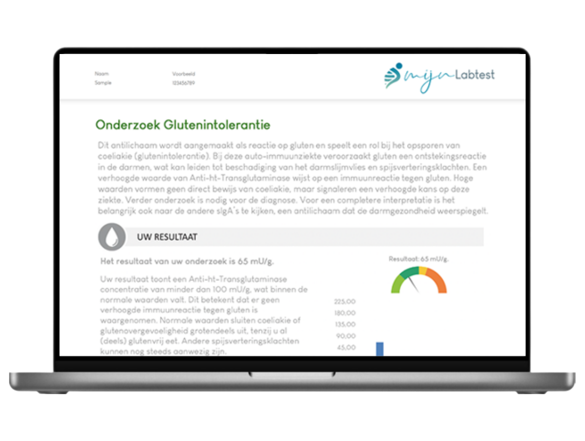 Smartphone met een voorbeeldrapport van de darmtest zelftest voor glutenintolerantie, met testresultaten en analyse.
Smartphone met een voorbeeldrapport van de darmtest zelftest voor glutenintolerantie, met testresultaten en analyse.
