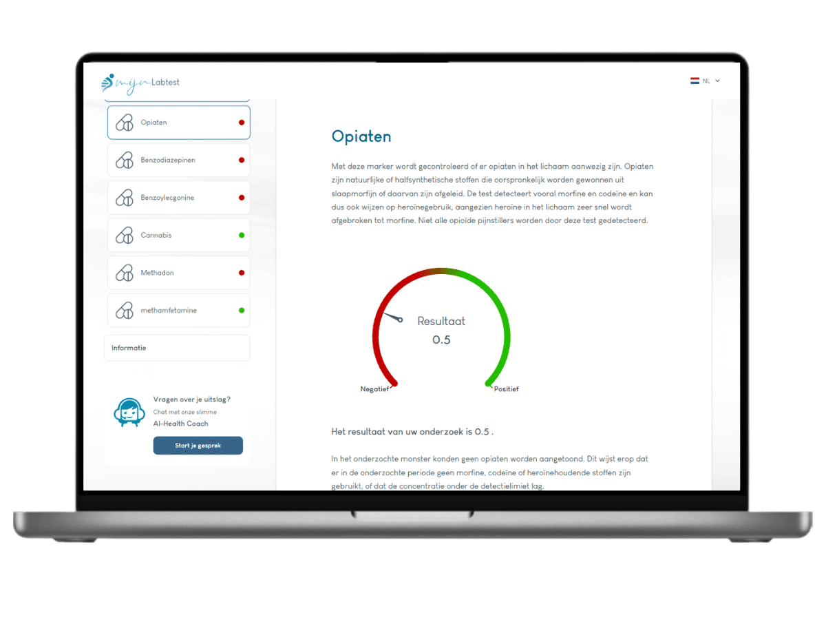 Opiaten resultaat drugs test Opiaten resultaat drugs test