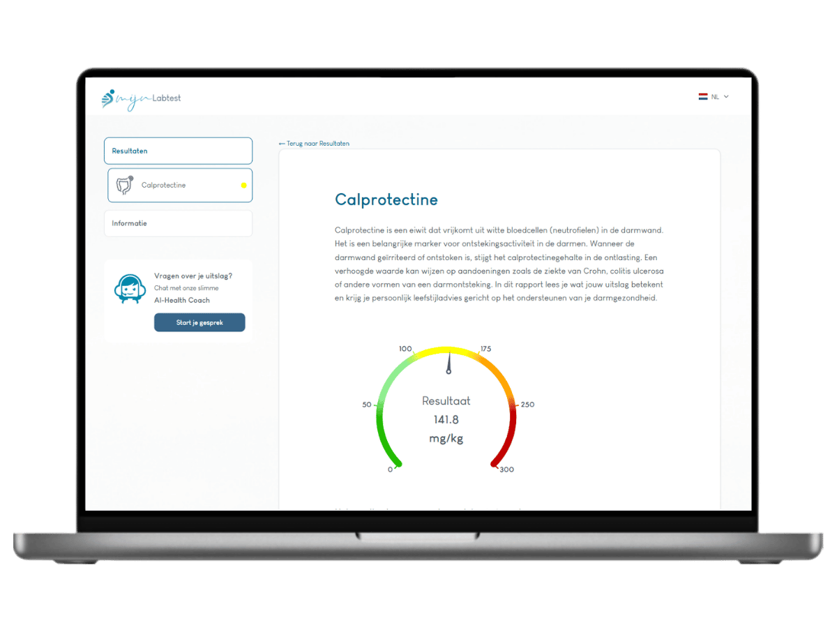 Zo ziet het resultaat van jouw Calprotectine waarde zelftest er uit. Het is het meest complete rapport met AI integratie en leefstijl advies.	