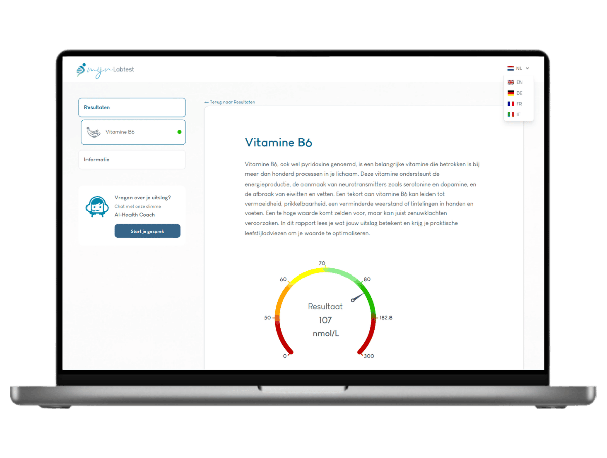 Zo ziet jouw vitamine B6 test resultaat eruit
Zo ziet jouw vitamine B6 test resultaat eruit