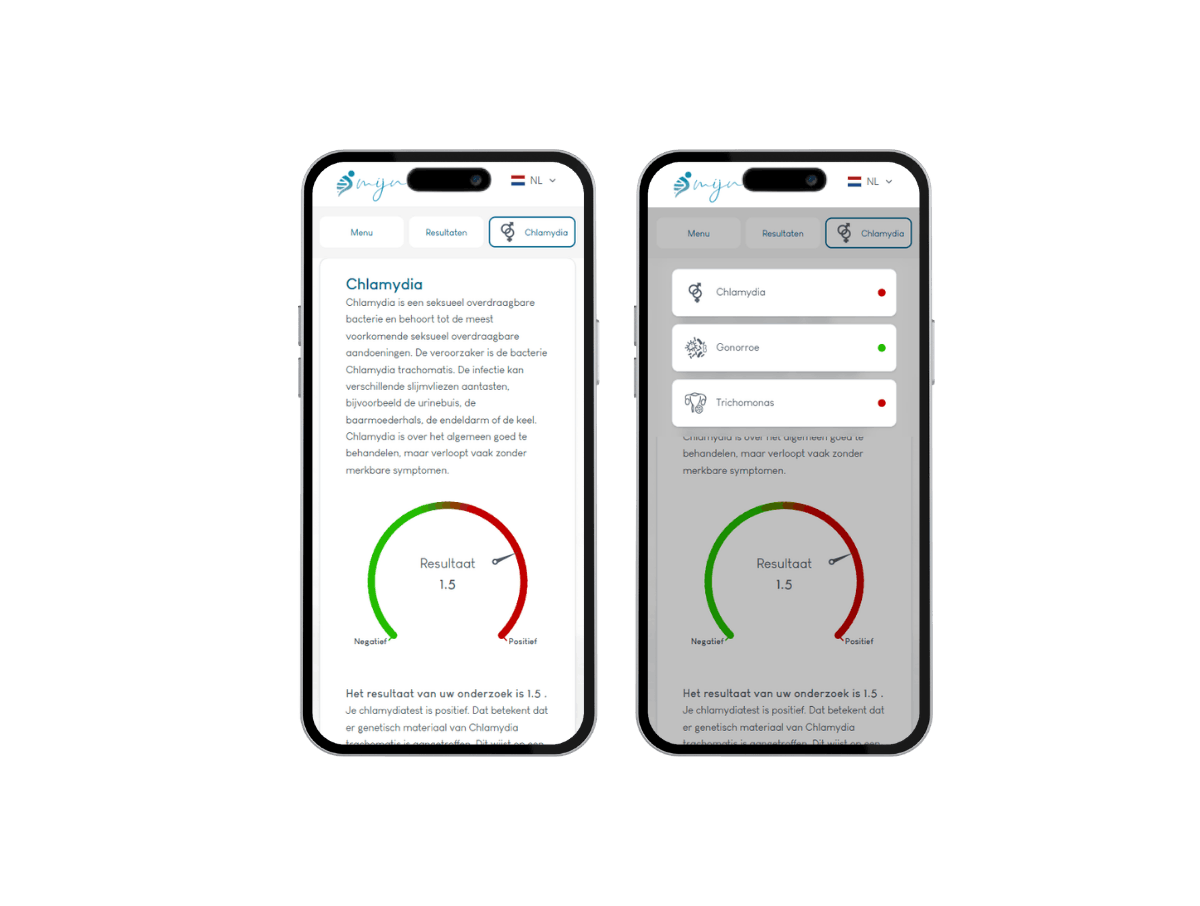 Telefoon resultaat Soa thuis test Telefoon resultaat Soa thuis test