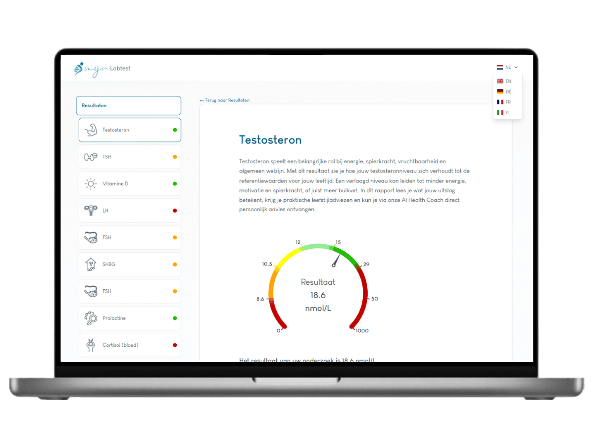 zo ziet het resultaat van je testosteron er uit. Het meest complete rapport met AI integratie en leefstijl advies.