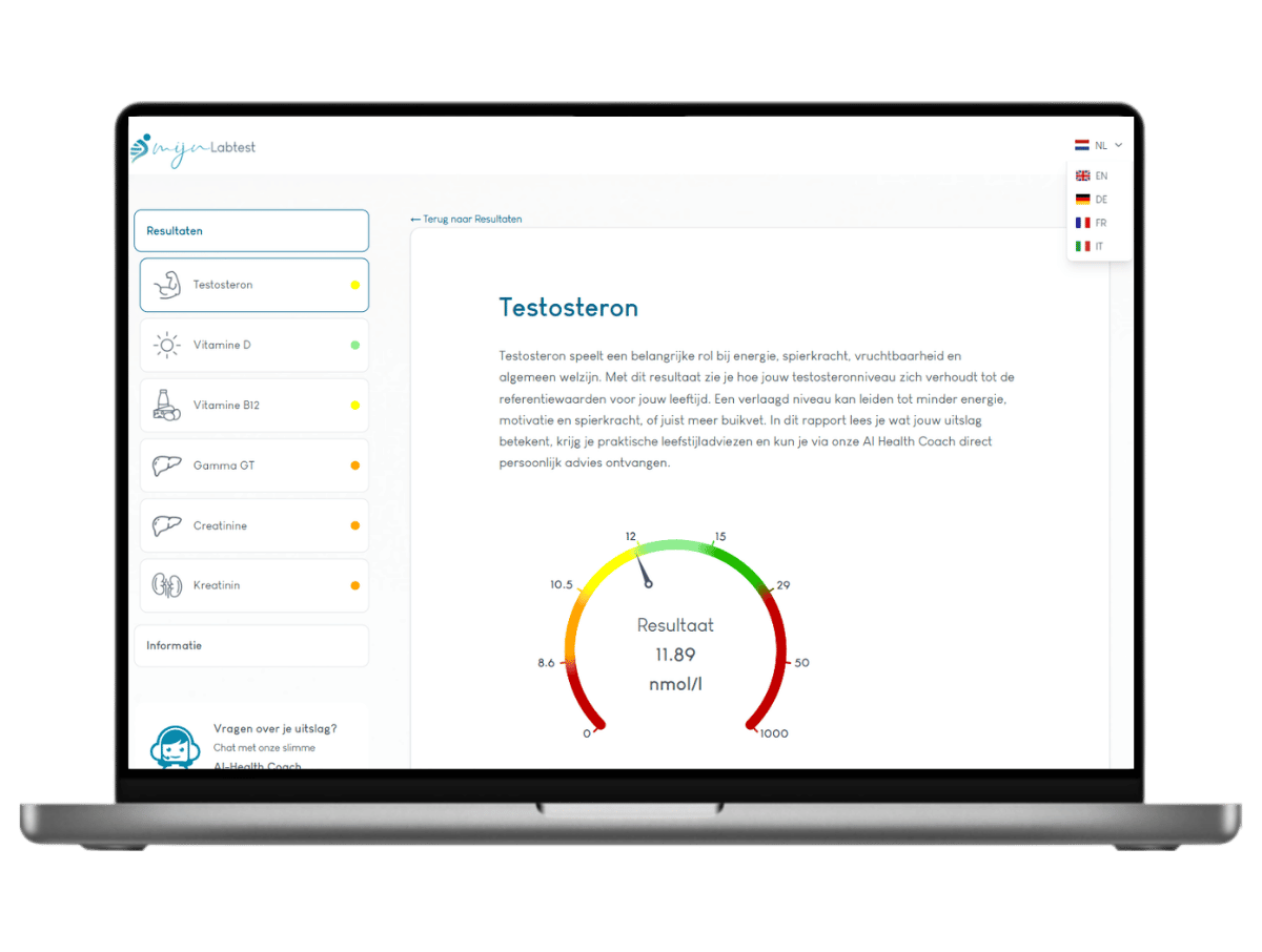 Zo ziet jouw testosteron resultaat eruit