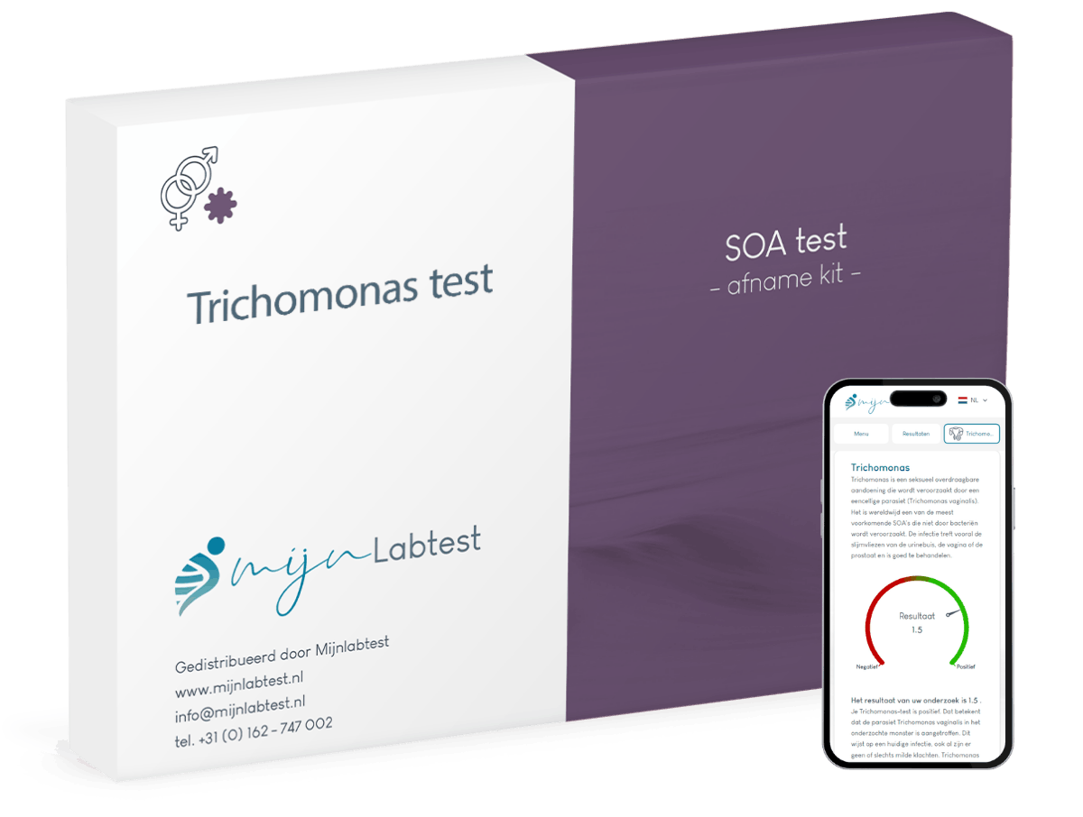 Trichomonas test