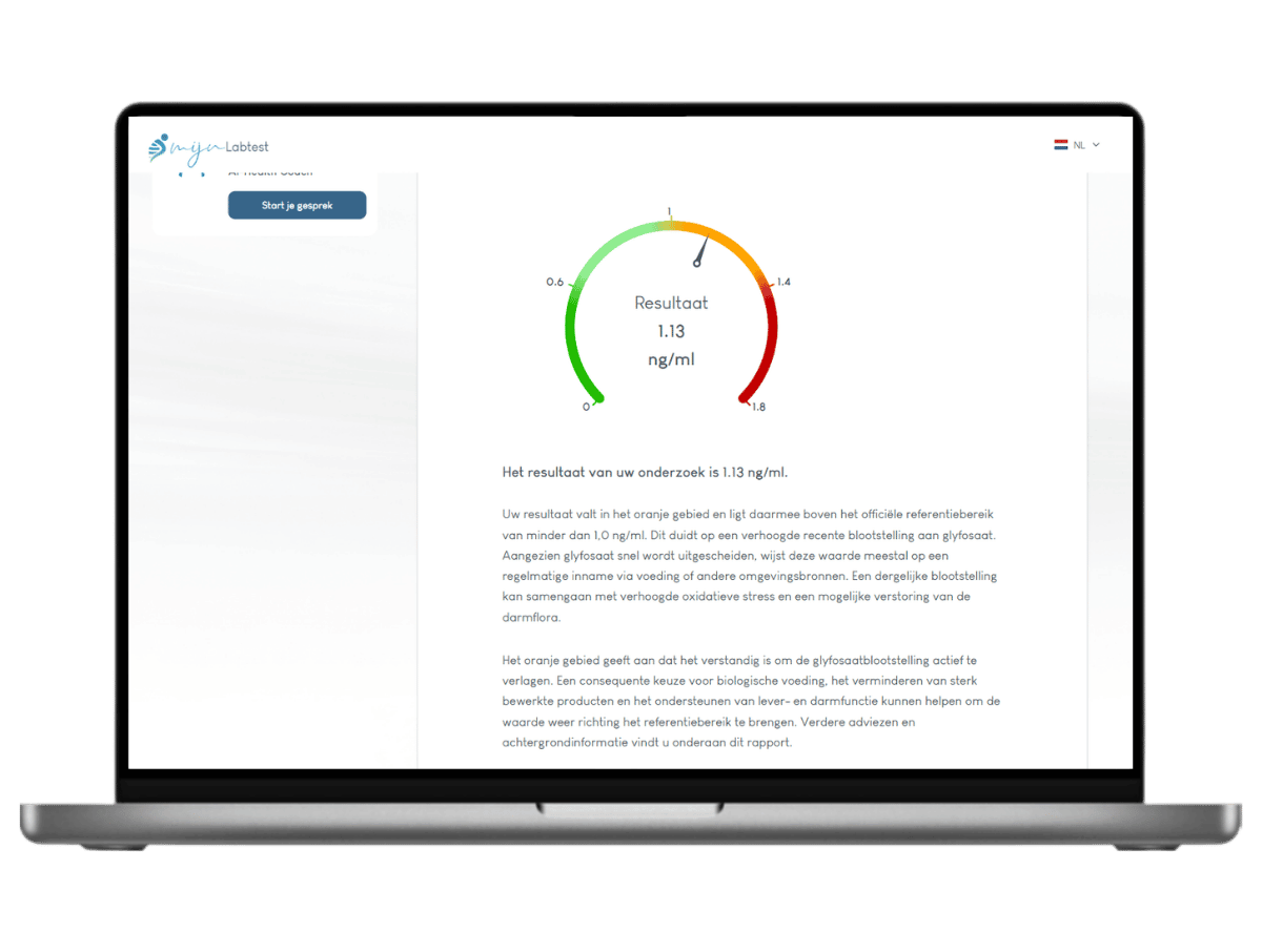 Uitgebreide informatie over jouw persoonlijk resultaat. inclusief leefstijl advies en AI intergratie