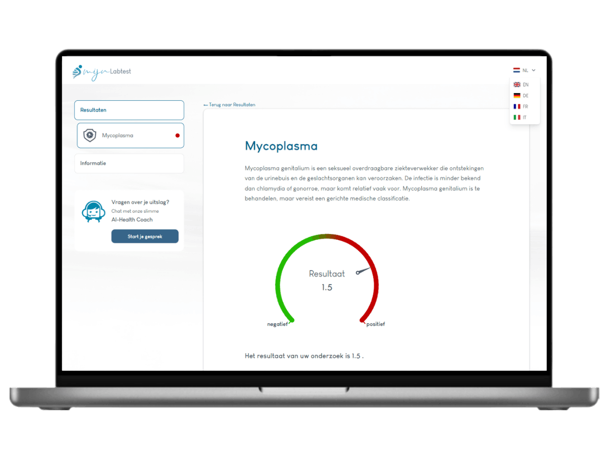 Zo ziet het resultaat van jouw Mycoplasma test er uit. Het is het meest complete rapport met AI integratie en leefstijl advies. Zo ziet het resultaat van jouw Mycoplasma test er uit. Het is het meest complete rapport met AI integratie en leefstijl advies.