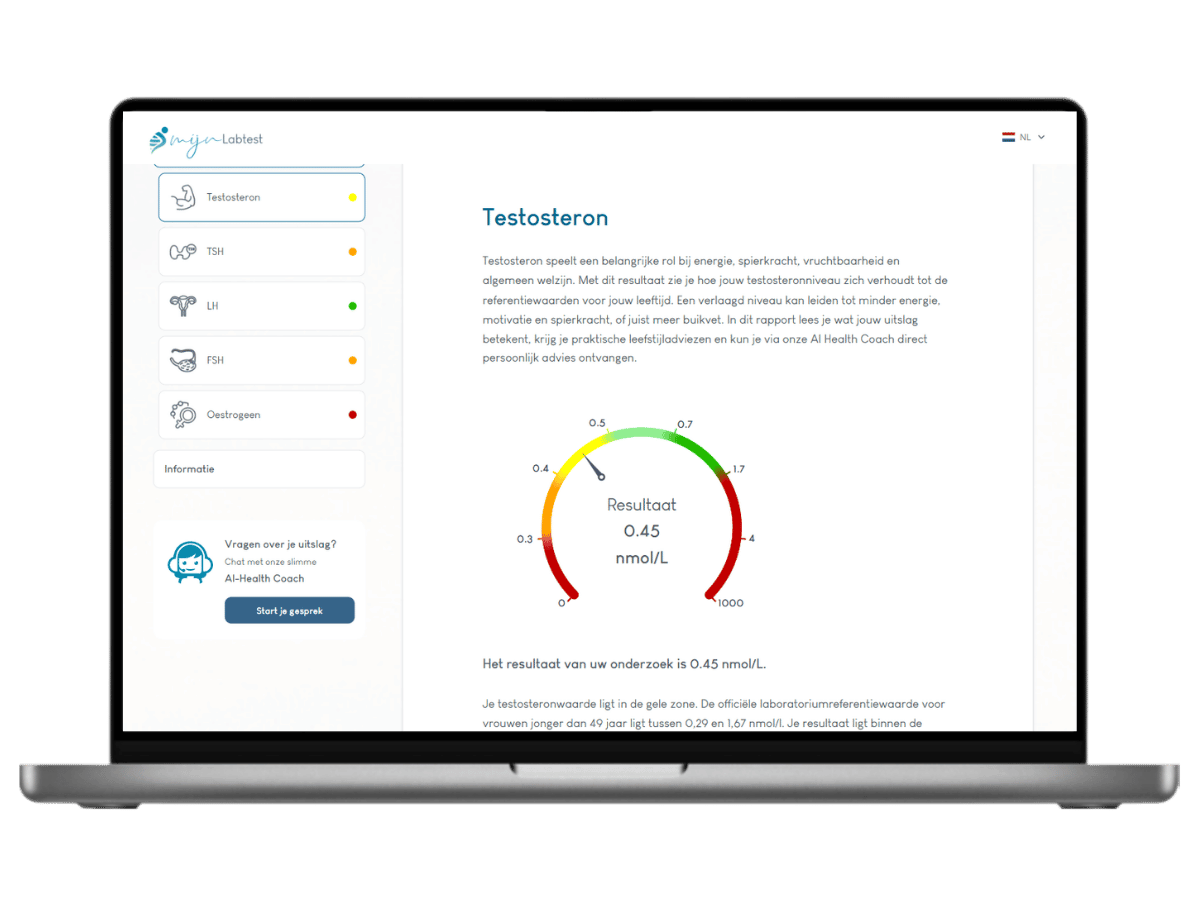 Dit is een voorbeeld van de testosteron test voor vrouwen, onderdeel van het complete hormoon profiel vrouwen bloedonderzoek.