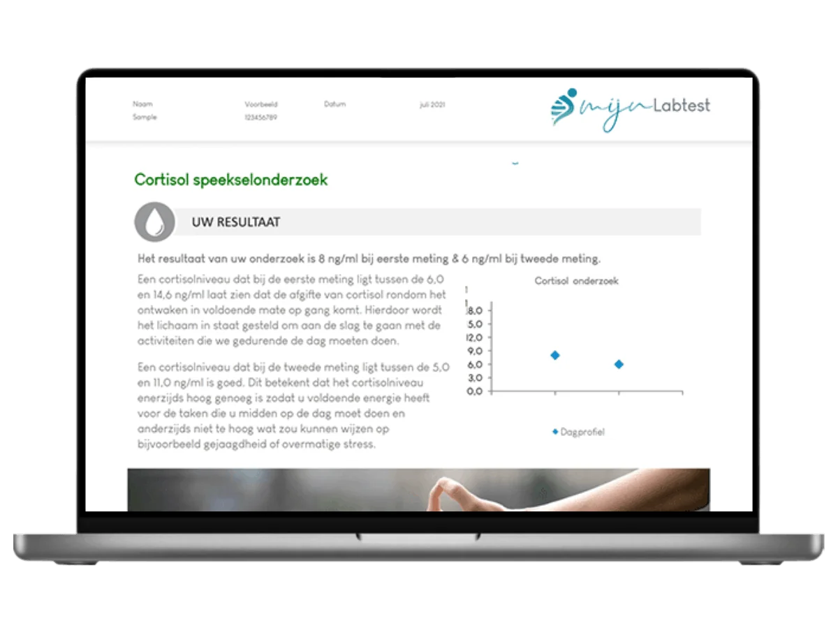 Voorbeeld van de Cortisol profiel + DHEA uitslag op een laptop