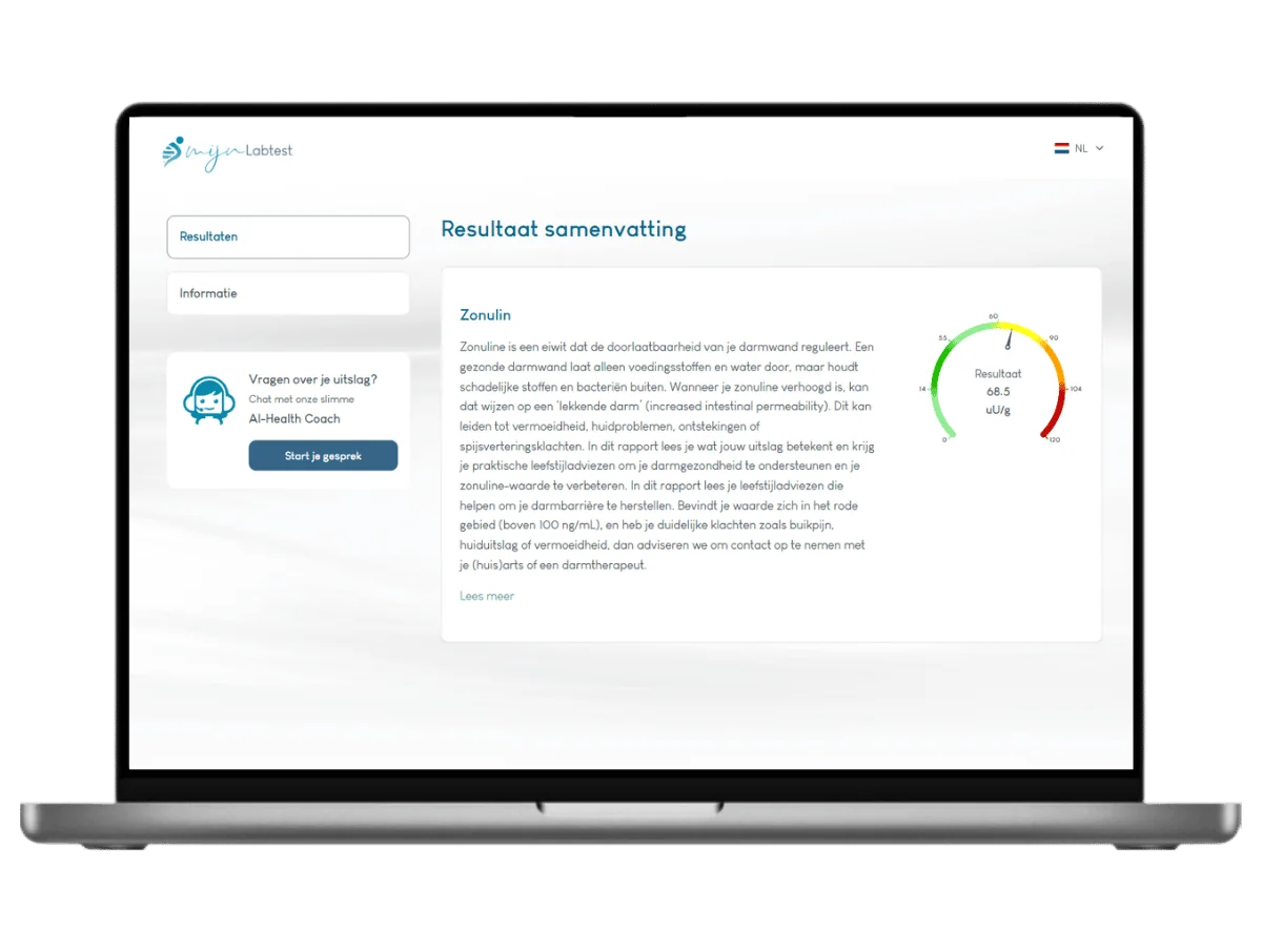 Voorbeeld van de Zonuline test uitslag op een laptop