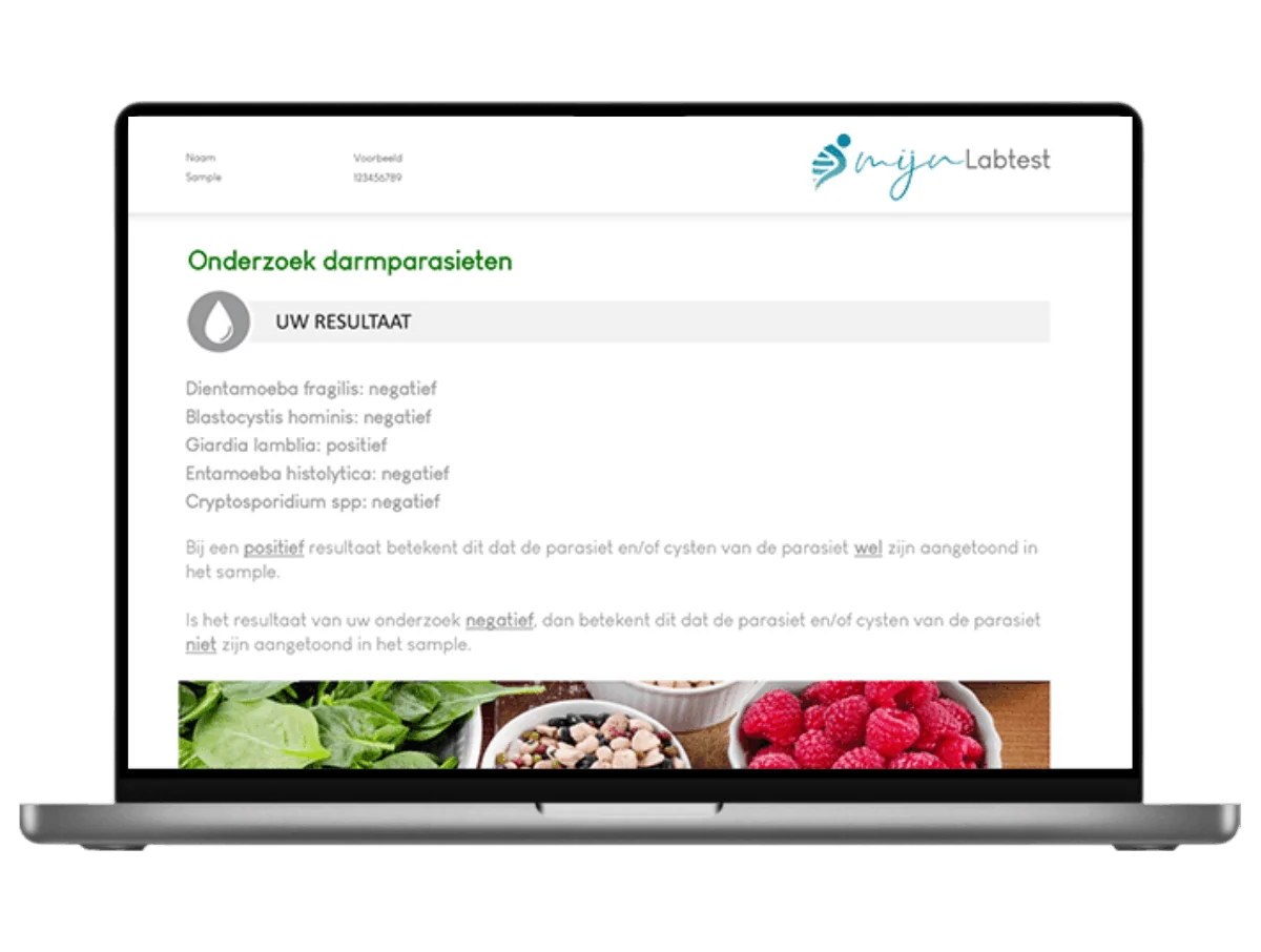 Voorbeeld van de Dientamoeba fragilis test uitslag op een laptop